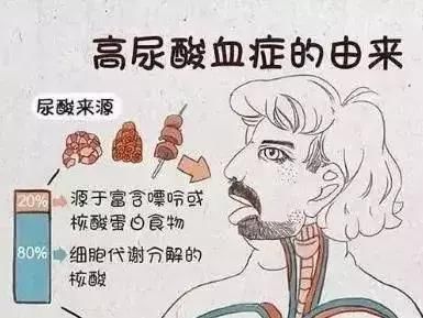 尿酸高的人一天能吃多少肉?