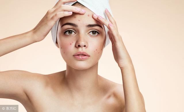 初期痤疮的症状有哪些?最为主要的几大针对于