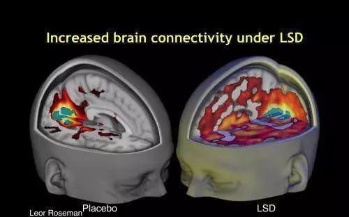 科学家揭示LSD毒品对大脑的影响,解释为何吸