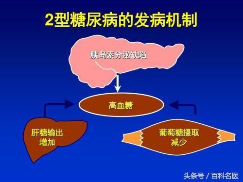 向红丁教你区分1型糖尿病和2型糖尿病！