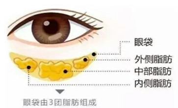 怎样可以去眼袋 t0180f680384470d350.jpg