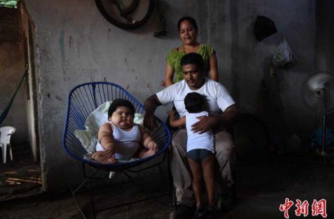 墨西哥10个月大婴儿重56斤 随时有生命危险