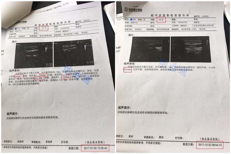 终于找到预防血栓的方法了!心脑血管疾病专家亲授，一定要为家人