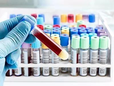 肿瘤小课堂小小血常规 反映大问题