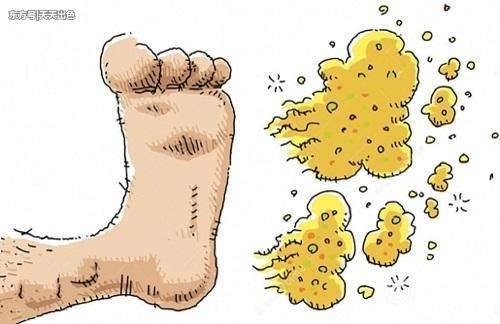 脚臭脚出汗不当回事?那是细菌正在滋生繁殖,患