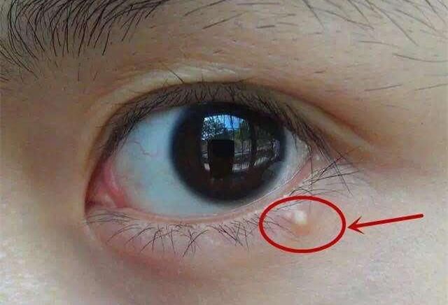 面膜撕开直接往脸上贴?大部分女人都做错了,难