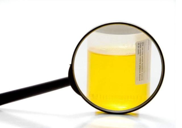 排尿时,尿液总是发黄?可能是这4个原因,早了解