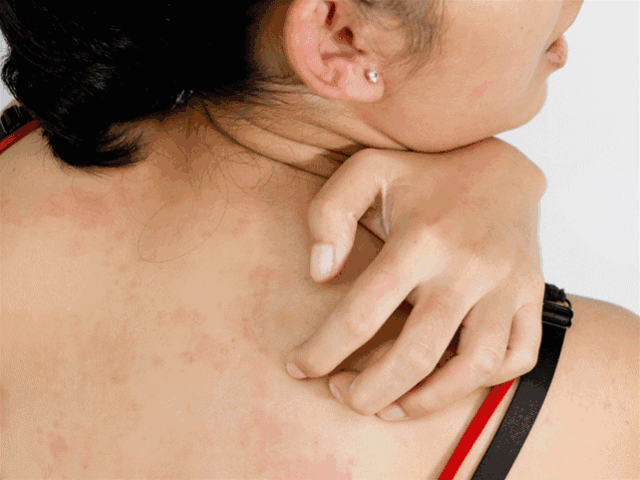 最省事且有用的除螨方法,一擦,螨虫全没了!