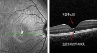 2秒即可点燃火柴,热门玩具激光笔威力究竟有多