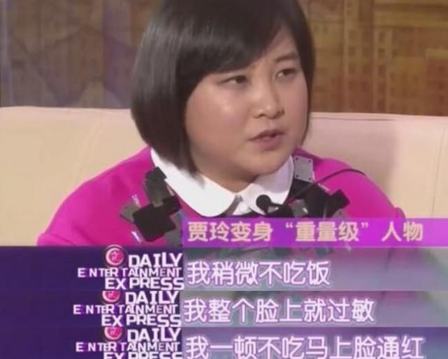 长了一张大饼脸却撑起搞笑界半边天,减肥后必瘦脸针打完脸摸起来硬图片