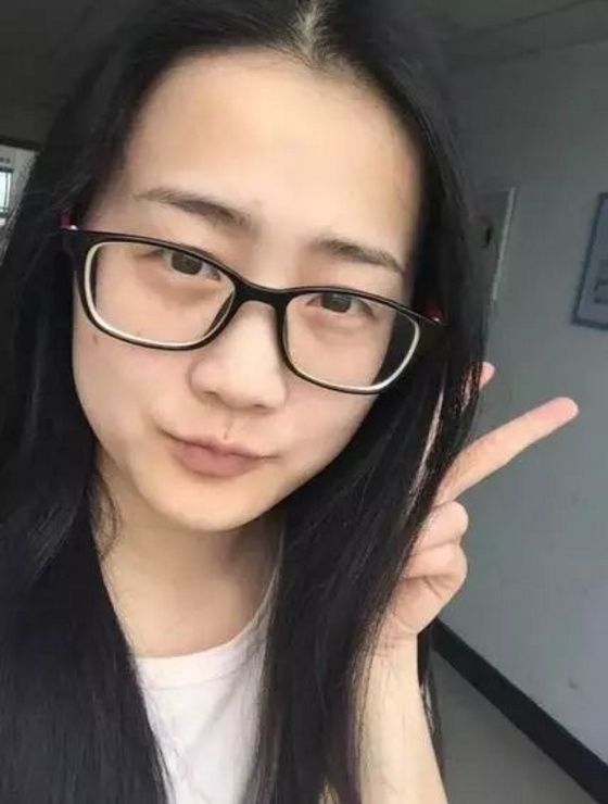 24岁女大学生因为脸上祛斑太多被多家学校拒