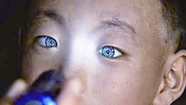 猫眼男孩的特殊异能,眼睛晚上能发光,像猫一样