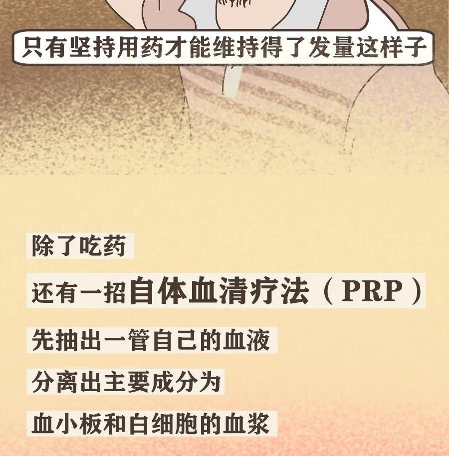 真男人，都容易秃