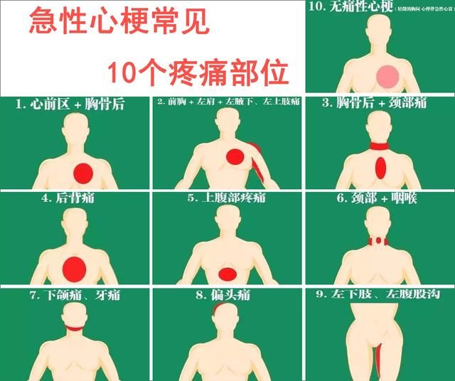 这10个部位疼痛，是心梗突发的先兆，早些发现可以救命