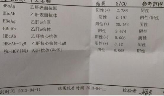 一般乙肝大三阳到肝硬化多长时间 乙肝大三阳肝硬化传染科