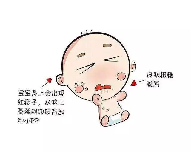 “婴幼儿湿疹”的那些流言，你了解吗?