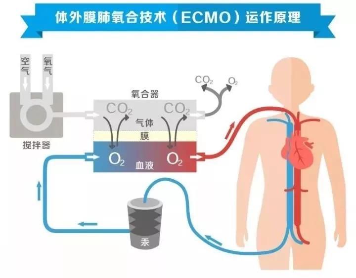 在这个流感肆虐的冬季，一位呼吸重症科医生的思考