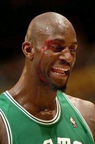 8图看NBA硬汉流血瞬间: 詹姆斯眼睛出血, 科比