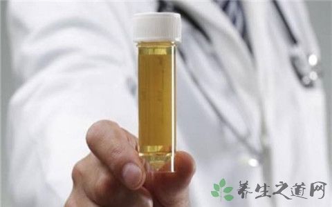 尿路感染可引起尿液的异常改变,常见的有细菌尿,脓尿,血尿和气尿等,尿