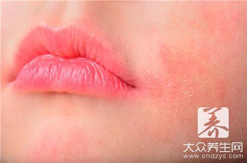 儿童特异性皮炎能好吗?_【快资讯】