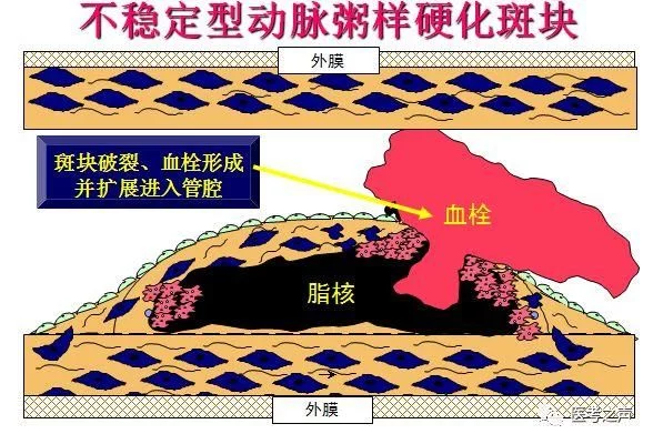 澳门太阳城:不看莫后悔:更痛、更久、更难治 澳门太阳城:不看莫后悔:更痛、更久、更难治