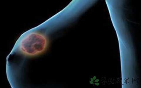 乳腺肿瘤可以哺乳吗