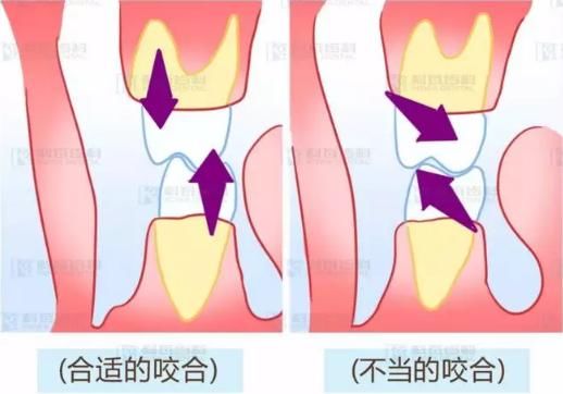 为什么吃冷热酸甜牙齿会酸痛？