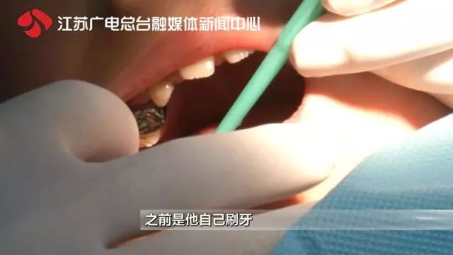 太可怕!19岁女孩一口牙齿“溶解”了…你也经常这样做