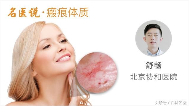 美女打耳洞后居然长出一个“新耳朵” 全因这种特殊体质