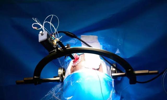 我市5G时代真的来了!首批基站开通,舟山人啥时