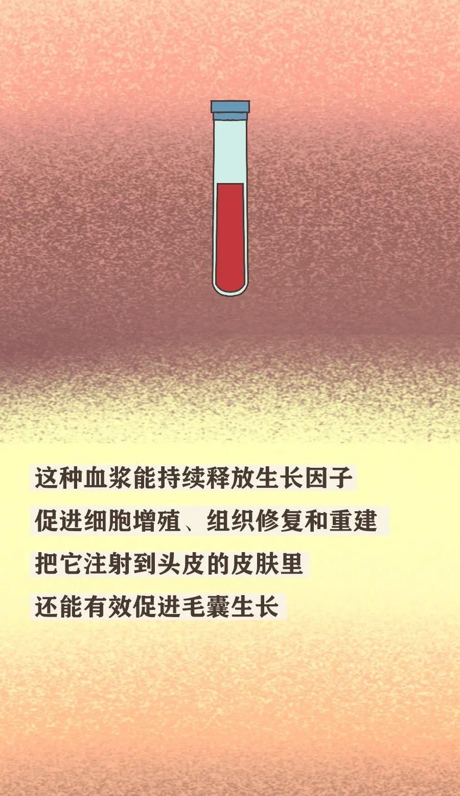 真男人，都容易秃
