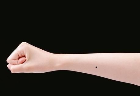 详细分析:女人手上长痣代表什么意思?看看就知