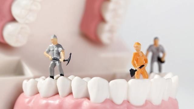 洗牙是为了洗掉牙结石吗?洗牙伤害牙齿吗?