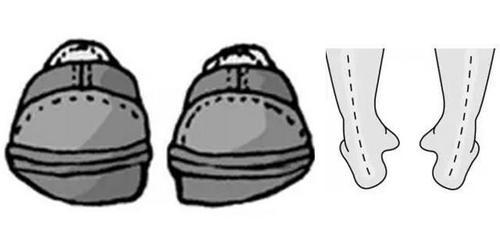 鞋后跟外侧磨损走路老是不小心扭到?是时候拯