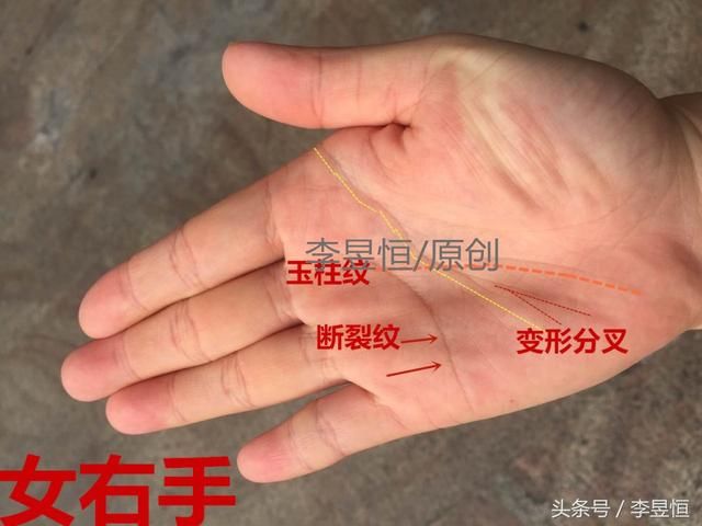 手相中小指外撇、玉柱纹直上，婚晚子迟子财运旺！