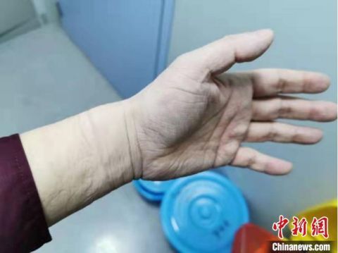 新型布尼亚病毒