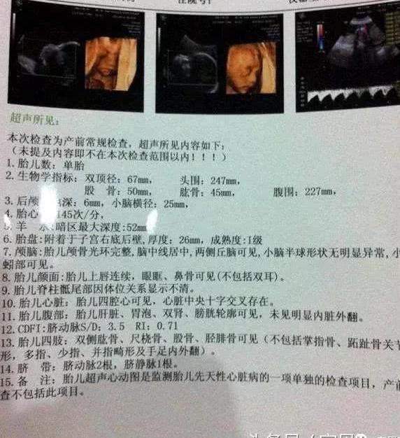 宝妈做四维回来了,确定是男宝宝了,彩超怎么看