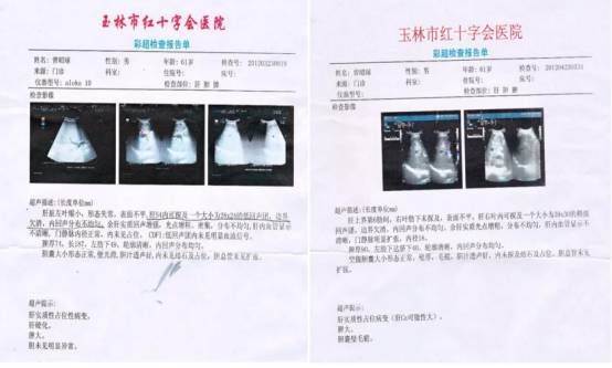 曾冰 走在量子修复医学的前沿