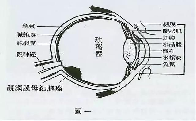 小凤雅的眼癌到底是什么？