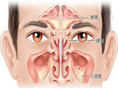医生有你:过敏性鼻炎该如何治疗?