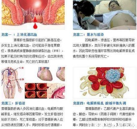 济南协和肝病医院专家指出:脂肪肝要治疗!拒绝