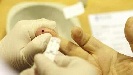 单位要体检,血常规检查能查出艾滋病吗?