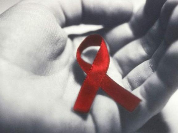 艾滋病早期,身上出现4个红色信号,早知道早健