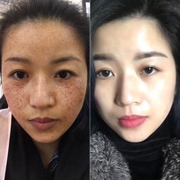 烂香蕉千万别扔,捣碎加上 维E 敷脸,祛斑祛皱_