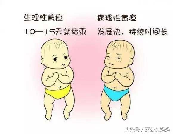 新生宝宝患母乳型黄疸，如何辨别？妈妈的母乳还要继续吗。