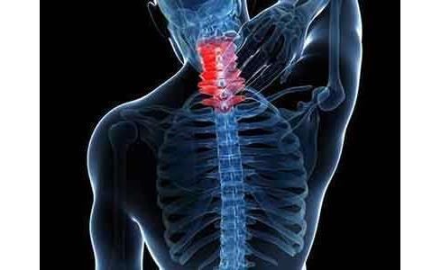 颈椎病,这3个症状有些人全中,你有几个呢?分享