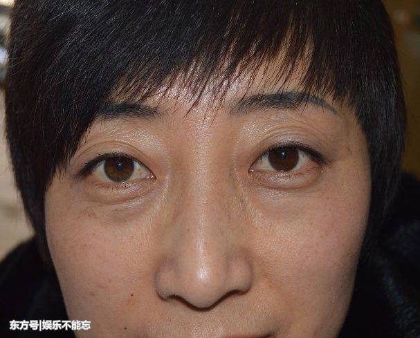 40岁的女人眼袋肿大?用家里的它贴一贴,消除