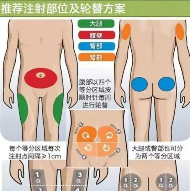 胰岛素怎样控制血糖