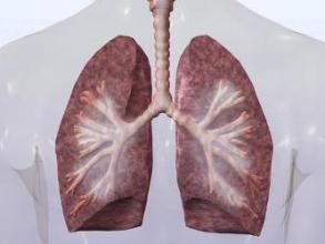 被诊断为早期肺癌怎么治疗?科普一下立体定向