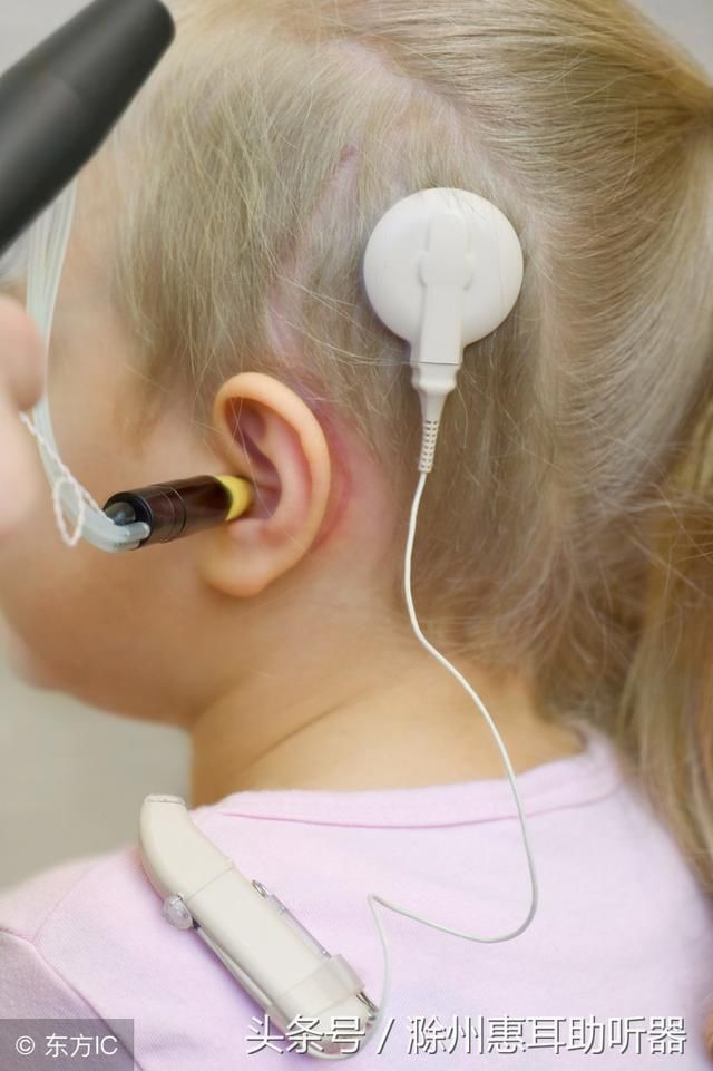人工耳蜗和助听器的区别滁州助听器